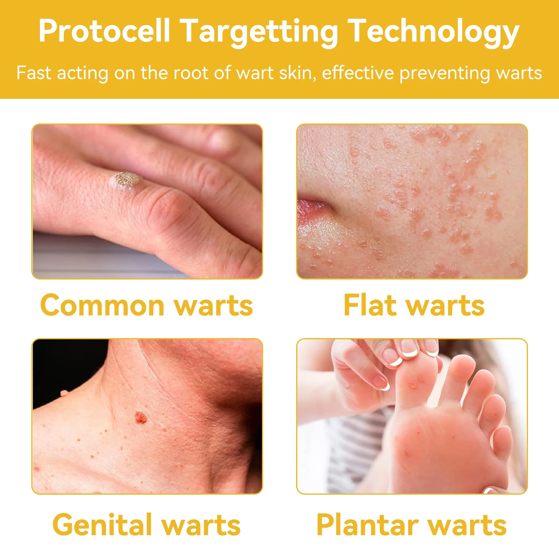 Tagaway - Effective Removal of Warts and Skin Growths